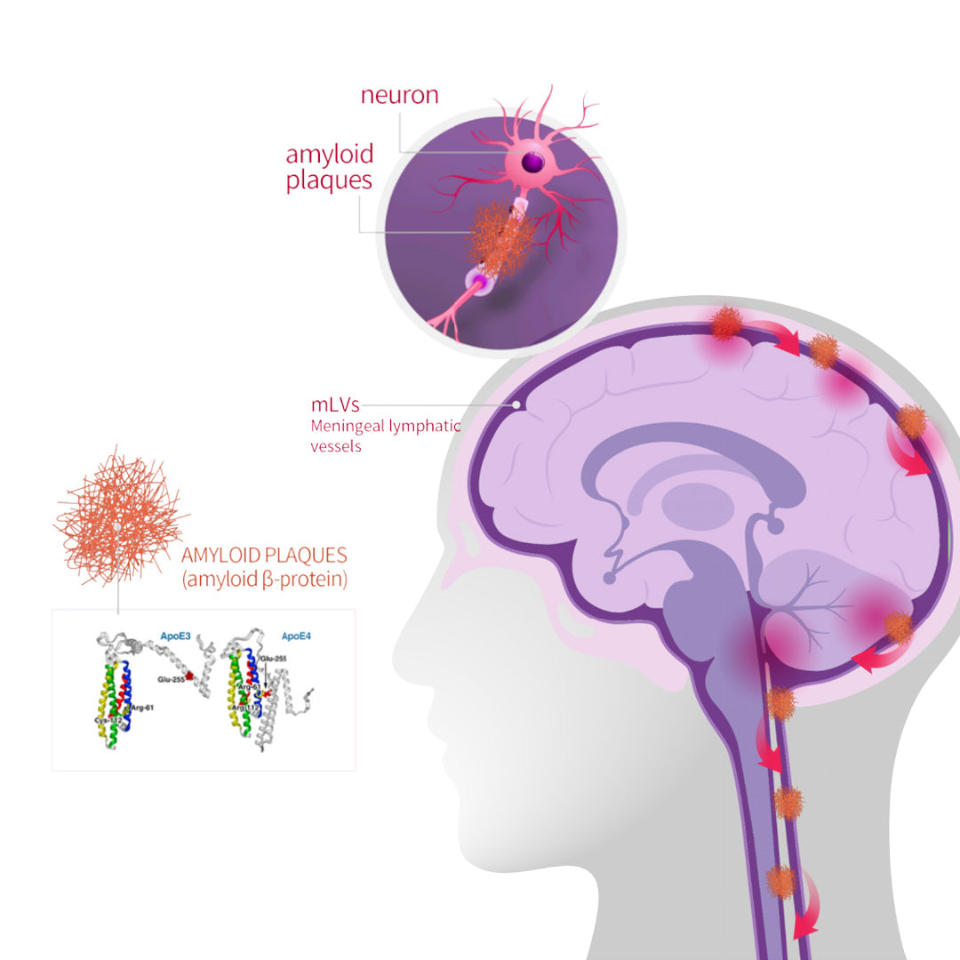 Koushicare 40HZ Gamma Light Therapy BrainBand